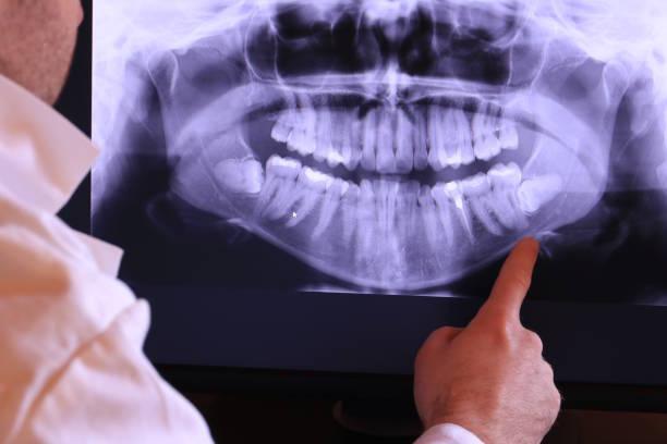 Best Emergency Gum Treatment in Breckenridge, MN